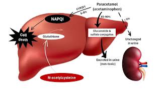 NAcetylcysteine amp Paracetamol Poisoning Rescue [upl. by Onaicnop]