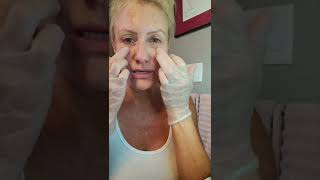 Getting better at Meso Mesotherapy with Miracle L  PCL DIY Facial [upl. by Etteyniv]