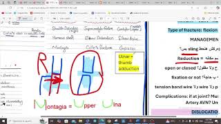 UPPER LIMB FRACTURES  ORTHOPEDICS  5TH YEAR [upl. by Lertram]