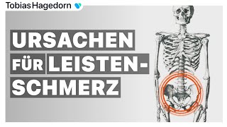 Leistenschmerz ✖️  Ursachen bei Schmerzen in der Leiste [upl. by Gibbon602]