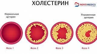 Xolesterinning organizm uchun quyidagi foydalari mavjud  NOVO MEDICS [upl. by Aela]