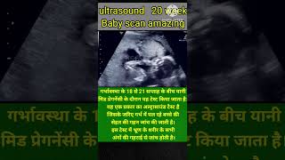 Anomaly Scan 20 week ultrasound20 week baby scan shortvideo ytshorts pregnancy pregnancytips [upl. by Simetra]