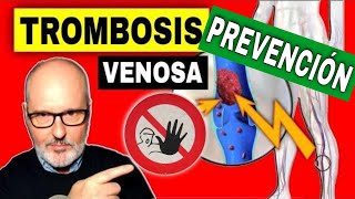 10 PASOS para EVITAR la TROMBOSIS VENOSA PROFUNDA en piernas [upl. by Ut]