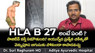 HLA B27  AYURVEDIC TREATMENT  ANKYLOSING SPONDYLITIS [upl. by Ehcar]