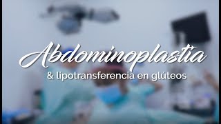 Lipotransferencia glútea con abdominoplastia [upl. by Modie]