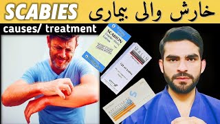 scabies in urdu hindi  cause symptoms amp treatment  kharish ka ilaj  खुजली [upl. by Weatherley]