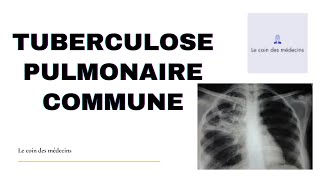 TUBERCULOSE PULMONAIRE COMMUNE [upl. by Yelyab406]