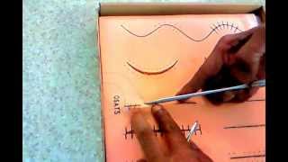 Simple Continuous Running Suturing Demo  Dr Sanjoy Sanyal [upl. by Mohr]