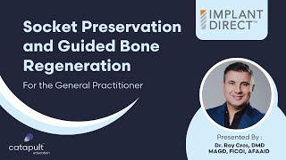 Dental Treatment Socket Preservation and Guided Bone Regeneration for GPs  Sep 28 2023 [upl. by Hnib102]