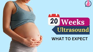 Pregnancy Ultrasound At 20 Weeks Anomaly Scan and What to Expect [upl. by Dolorita]