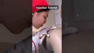 Injection Tutorial tutorial injection shorts littos [upl. by Berthoud]