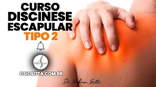 DISCINESE ESCAPULAR TIPO 2 da TEORIA ao TRATAMENTO Clínica de Fisioterapia Dr Robson Sitta [upl. by Boycey440]