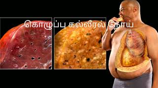 liver issues symptoms tamilliver is not working properly symptoms tamilliver problems tamil [upl. by Aicatsue]