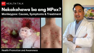 Nakakahawa ba ng Mpox Monkeypox Causes risk factors symptoms treatment and prevention [upl. by Neelra879]