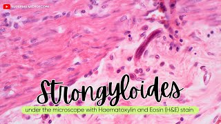 Strongyloides under the microscope with Haematoxylin and Eosin HampE stain [upl. by Tratner]