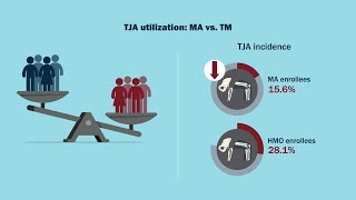 Medicare Advantage Is Associated with Lower Utilization of Total Joint Arthroplasty [upl. by Phira49]