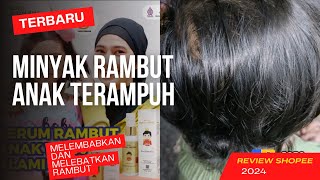 Unboxing amp Review Minyak Rambut Anak Ampuh Menebalkan Rambut [upl. by Humbert]