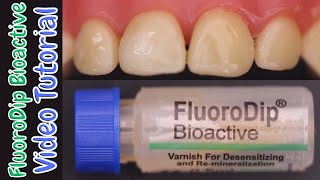 FluoroDip BioactiveA Revolutionary Fluoride Varnish with BIOGLASS 🔵 How To use amp Why To Use 🟢 [upl. by Maltz]