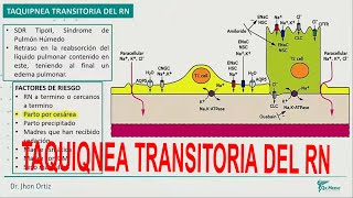 TAQUIPNEA TRANSITORIA DEL RECIEN NACIDO  NEO [upl. by Jemma]