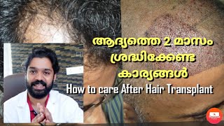 Part 2  ആദ്യത്തെ 2 മാസം ശ്രദ്ധിക്കേണ്ട കാര്യങ്ങൾ  How to care after Hair Transplant ✅ [upl. by Nnylirak]