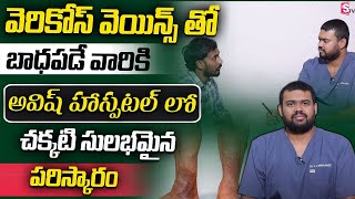 Best Varicose Veins Treatment In Telugu  How to Get Rid Varicose Veins In Telugu  SumanTV Prime [upl. by Sivi]