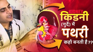 FullVideo👉HUMAN KIDNEY amp KIDNEY STONE  किडनीगुर्दे अंदर से कैसी होती है और इसमें पथरी कहाँ बनती है [upl. by Dante157]