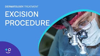 Excision Overview and Procedure Dermatology [upl. by Ayra622]