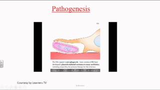 Haemophilus [upl. by Firehs662]