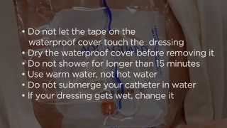 Showering While You Have a Central Venous Catheter  Memorial Sloan Kettering [upl. by Aros]