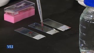 Plasmolysis and DePlasmolysis in Blood Preparation of Blood Smears  Practical  ZOO514PLecture03 [upl. by Bradford]