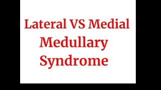 Lateral VS medial medullary syndrome [upl. by Jamille]