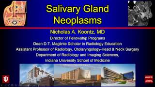 Salivary Gland Neoplasms [upl. by September]