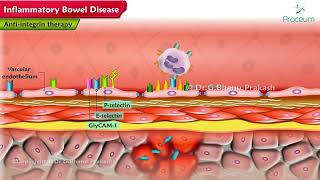 Inflammatory Bowel Disease Pharmacology Lectures [upl. by Naraj838]