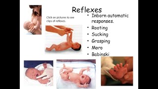 newborn reflexes [upl. by Eelesor]