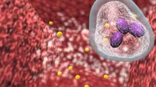 Bacterial infection and host response [upl. by Annai]