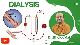 Dialysis  Hemodialysis CRRT  Class 12 Biology  by Dr Bhojoo Mal [upl. by Hazem]