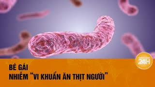 Bé gái 14 tuổi ở Đồng Nai nhiễm “vi khuẩn ăn thịt người” Toàn cảnh 24h [upl. by Arjun300]