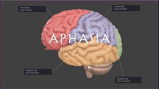 Brocas or Wernickes Aphasia on the NPTE [upl. by Evanthe]