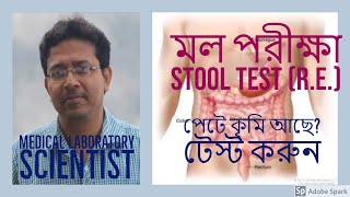 মল পরীক্ষা Stool Test Stool Analysisপায়খানা পরীক্ষা Mol Pariksha [upl. by Ecnerrot]