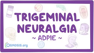 Trigeminal neuralgia Nursing Process ADPIE [upl. by Adnale823]