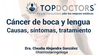 Cáncer de boca y lengua causas síntomas tratamiento [upl. by Resarf]