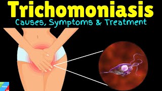 Trichomoniasis Causes Symptoms Diagnosis Treatments and prevention [upl. by Gavini]