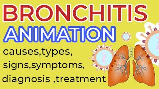 Bronchitis bronchitis animation  bronchitis symptoms treatment  bronchitis cough sound  3D [upl. by Rossen789]