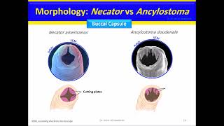 Nematodes Hookworm Ancylostoma duodenale Necator americanus [upl. by Siravrat]