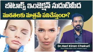 Botox Treatment for Face Telugu  Botox Myths vs Facts What You Really Need to Know  ReDefine [upl. by Keener]