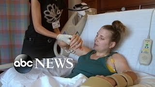 Lindsay Ess Story Part 1 Quadruple Amputee Undergoes Double Hand Transplant Surgery [upl. by Alaj]