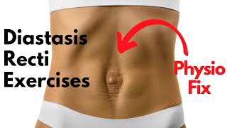 How to START Diastasis Recti Exercises that FIX YOUR GAP  PHYSIO GUIDED Abdo Separation Repair [upl. by Hartill]