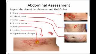 ASSESSMENT OF ABDOMEN RECTUM AND ANUS [upl. by Bili]