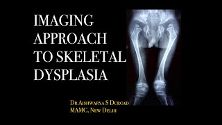 IMAGING APPROACH TO SKELETAL DYSPLASIA Skeletal survey l Types of dysplasia l Xrays l [upl. by Eissolf]