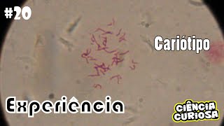 Experimento  Microscopia Cariótipo [upl. by Nosaes]